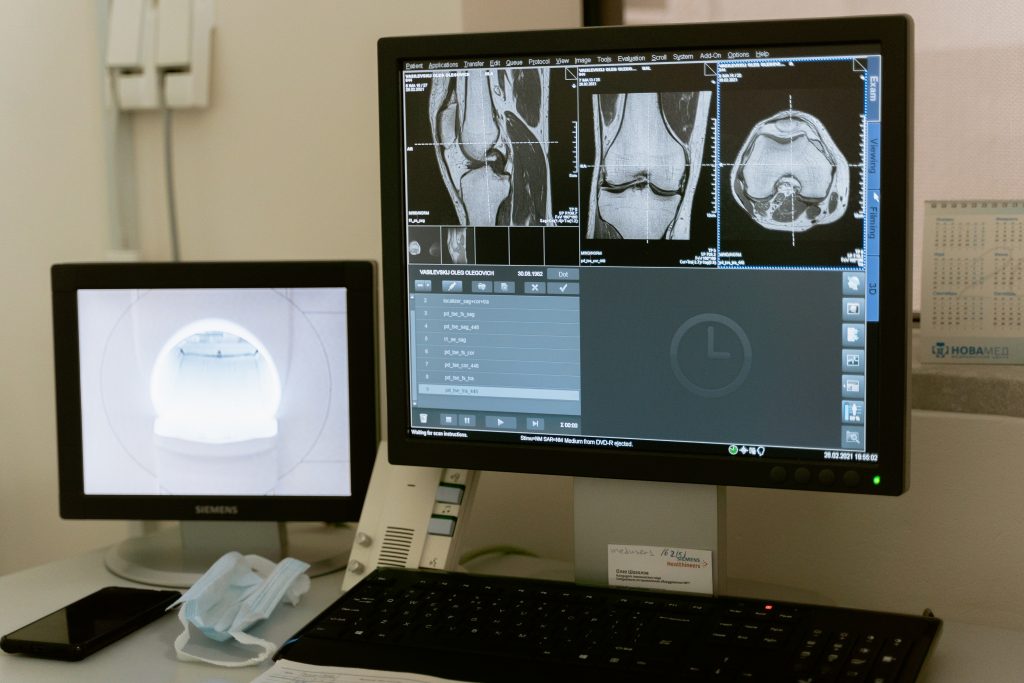 using healthcare analytics to detect anomalies in scans 